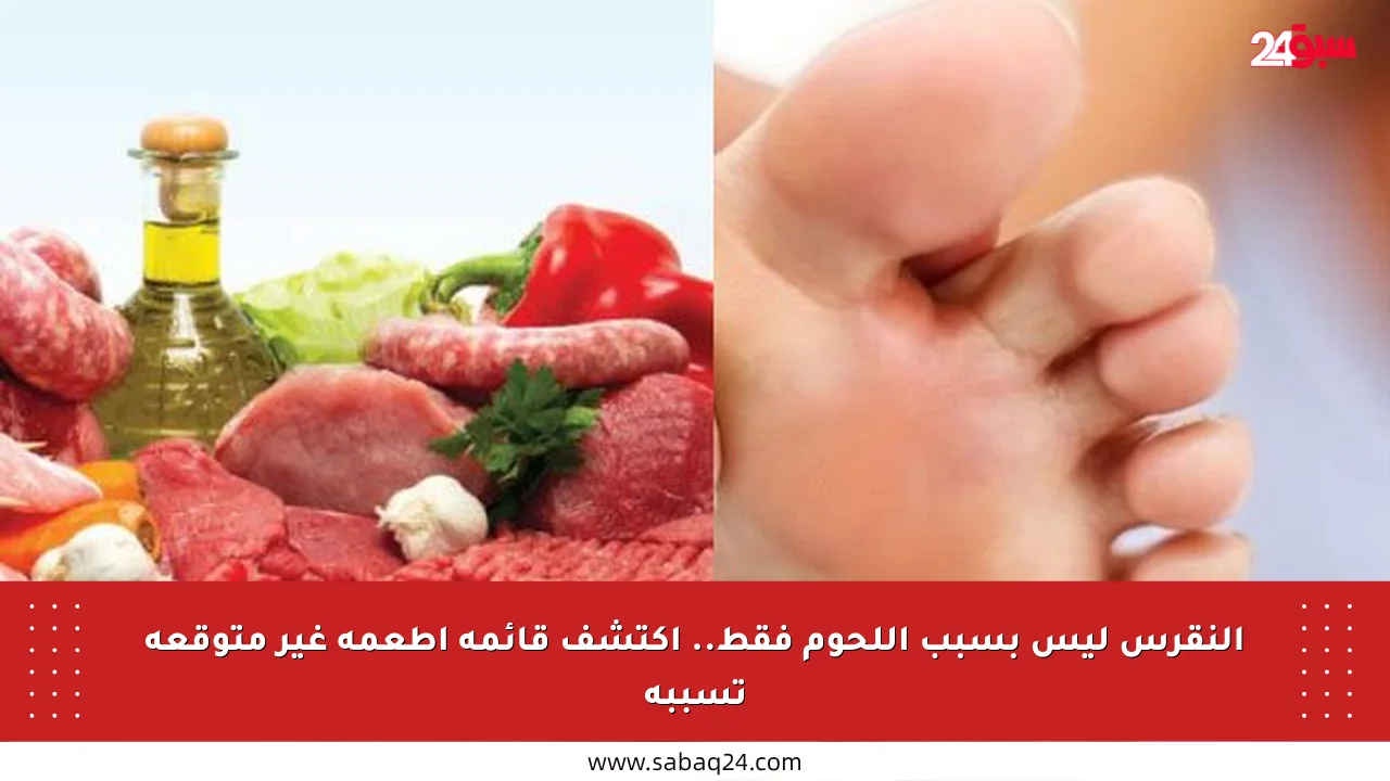 النقرس ليس بسبب اللحوم فقط.. اكتشف قائمة أطعمة غير متوقعة تسببه